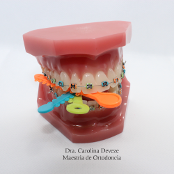 Dentista Carolina Deveze - Ortodoncista/brackets