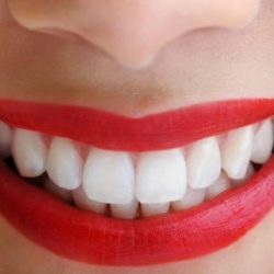 Dentista Cuernavaca