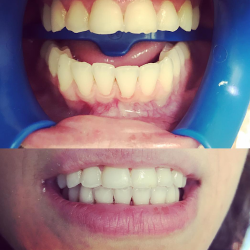 Dentista Daniel Hervias