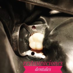 Dentista De Niños Y Adultos Con Ansiedad Dental D Up Ecatepec