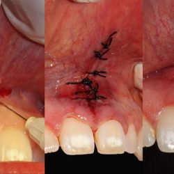 Dentista Diana Bahena Mac Irapuato