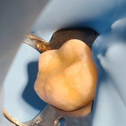 Dentista - Dr. Jonathan Ramirez - Dentista Silao