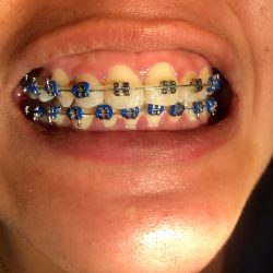 Dentista Dra.eva Maria Sandoval Garces
