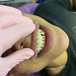 Dentista Dra Gabriela Ledezma