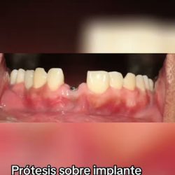 Dentista En Chilpancingo- Clínica Dental Palmas
