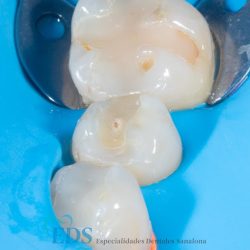 Dentista En Culiacán - Especialidades Dentales Sanalona