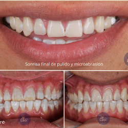 Dentista En Guadalajara – Blanqueamiento, Carillas Y Diseño De Sonrisa | Dr. Leo
