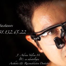 Dentista En Nogales Implantes Dentales & Restauración Oral