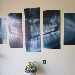 Dentista En Salamanca "centro Dental Integral"