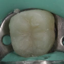Dentista. Especialista En Endodoncia. (odontologia De Minima Invasion)