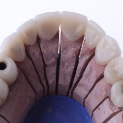 Dentista Especialista En Implantes Dra.clarisa Reyes Implantes Y Rehabilitacion Oral Con Alta Estetica