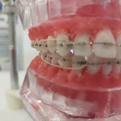 Dentista Finy