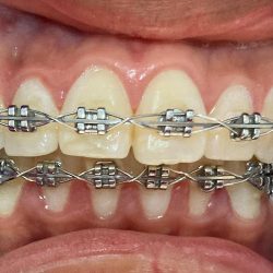 Dentista