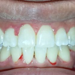 Dentista