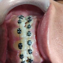 Dentista