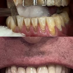 Dentista