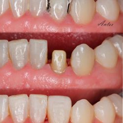 Dentista Heber Chávez