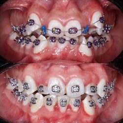 Dentista Ixtlahuaca