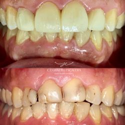 Dentista Janeth Escalera