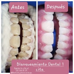 Dentista Johana Verdugo