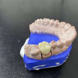Dentista José Techalotzi Galindo