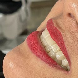 Dentista Katia Reyes/loreto Dental