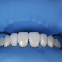 Dentista Lucio Peñaloza Odontología General Y Especializada