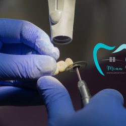 Dentista Mina Dental