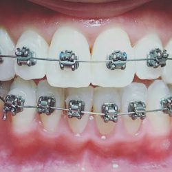 Dentista Mónica Odett