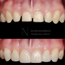 Dentista Nenetzi Rodríguez