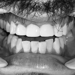 Dentista O´dentale Dr. Jarabak