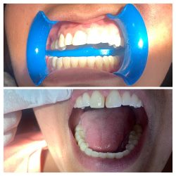 Dentista Odontología Integral Aztlán