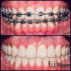 Dentista Optident