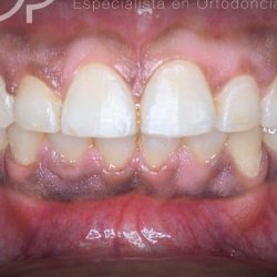 Dentista Orthodontica
