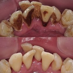 Dentista Osmara Campos