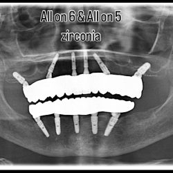 Dentista Santa Anita
