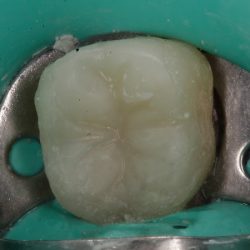 Dentista Sergio Valdes. Endodoncista.