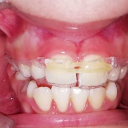Dentista Smilemed - Clínica Dental