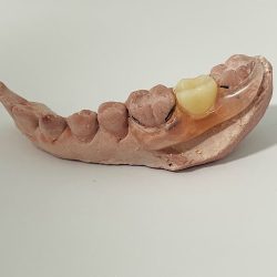Dentista Solidaridad | Dental Room | Dra.jenny Contreras