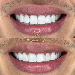 Dentista Tijuana- Dra. Mariel Gastelum