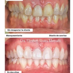 Dentistaclinica Dental Saludent Diseño De Sonrisa