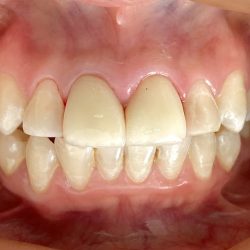 Dentistas Militares Especialistas