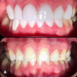 Dentistas Tijuana Kl