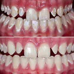 Dentiva Gdl - Clínica Dental