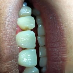 Dentxpress Dtm
