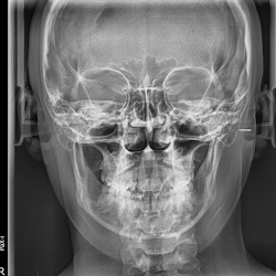 DiagnÓstico Radiodental PÁtzcuaro