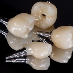 Digital Dental Studio Cdep Luis Nuñez