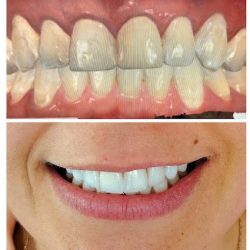 Diseñando Sonrisas - Consultorio Dental