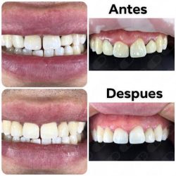 Dr. Alejandro Uribe Marioni, Dentista - Odontólogo Rehabilitación Oral E Implantologia