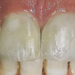 Dr Alex Gamboa. Unidad Dental